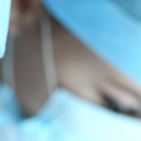 Surgeon head shot in the operating theatre  